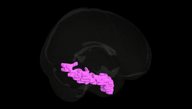 Full Brain Black