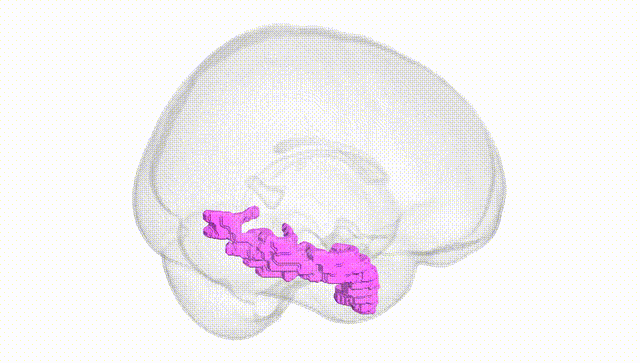 Full Brain White