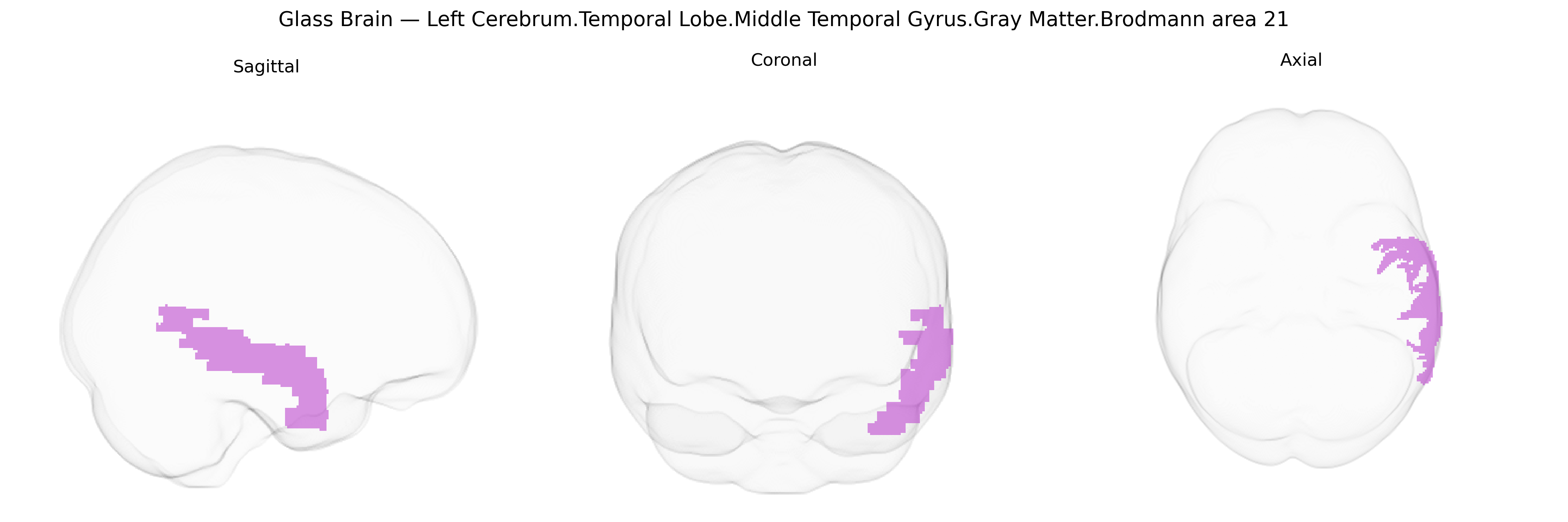 Triplanar Ghost Brain
