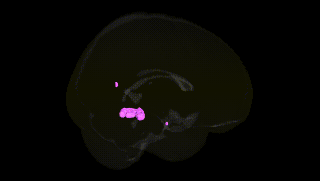 Full Brain Black