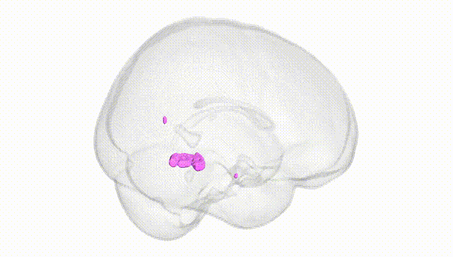 Full Brain White