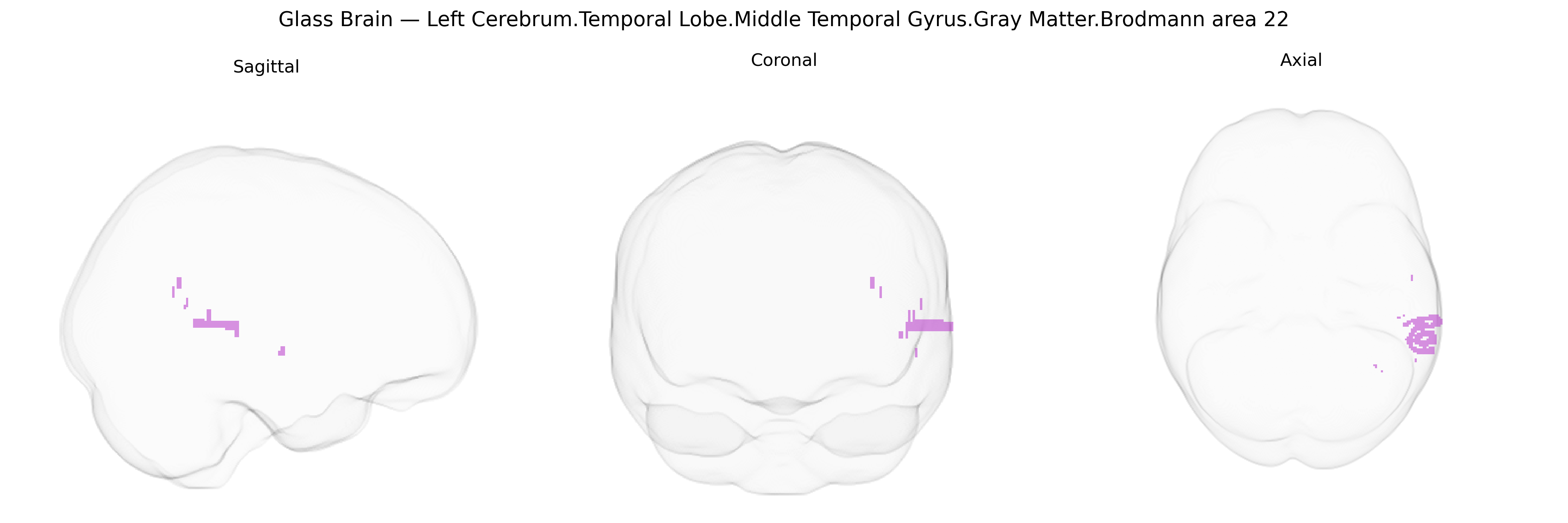 Triplanar Ghost Brain