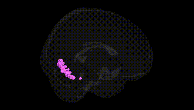 Full Brain Black