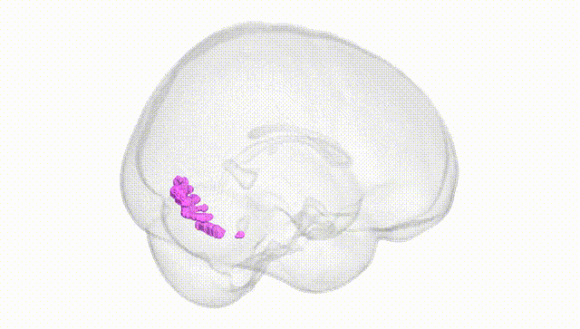 Full Brain White