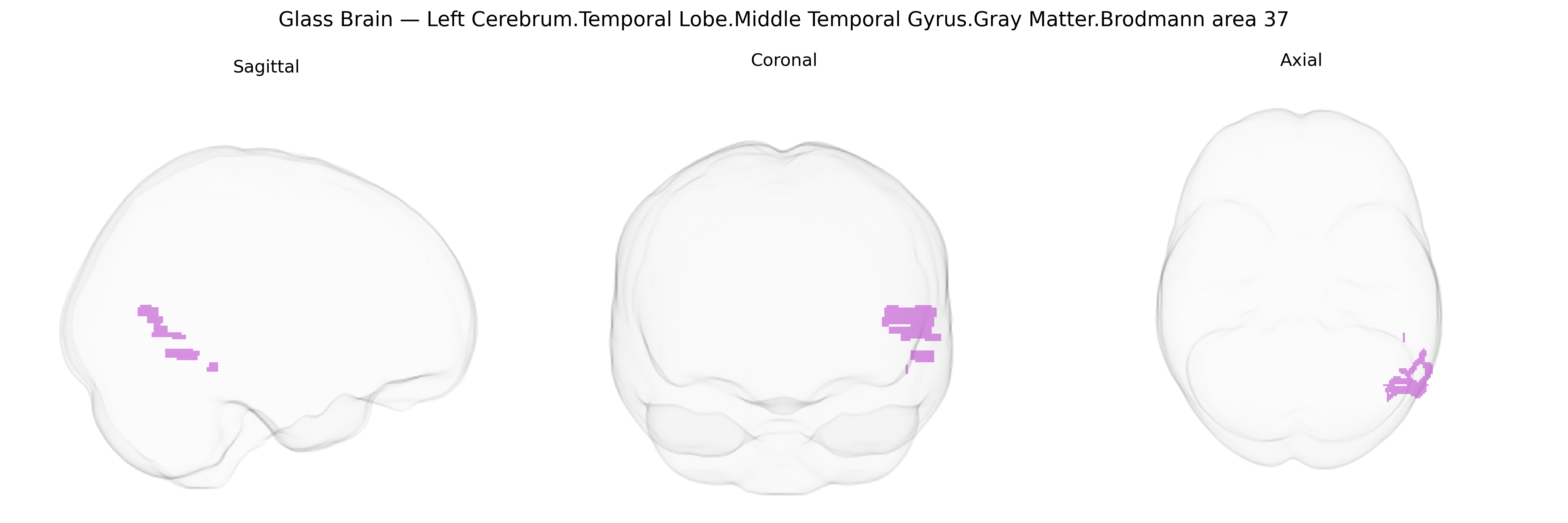 Triplanar Ghost Brain