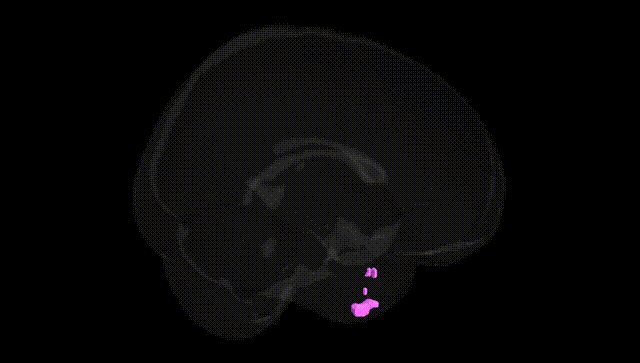 Full Brain Black