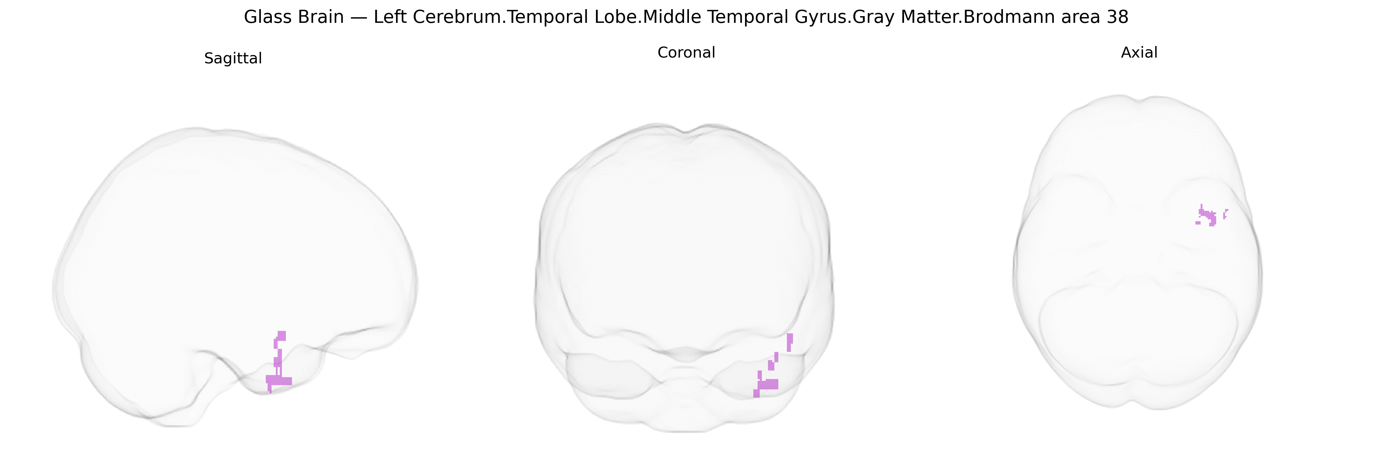Triplanar Ghost Brain