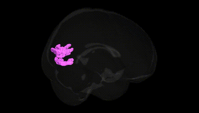 Full Brain Black