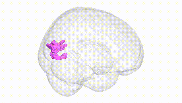 Full Brain White