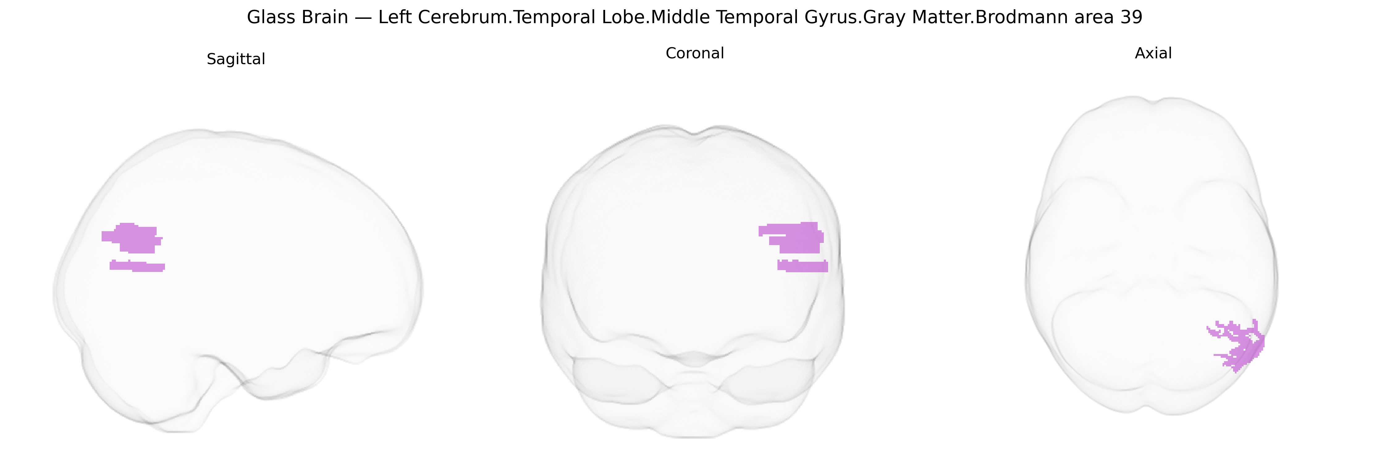 Triplanar Ghost Brain