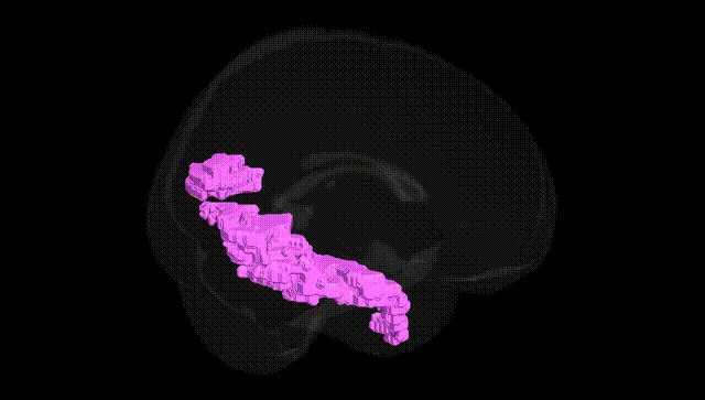 Full Brain Black