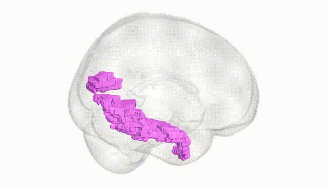 Full Brain White