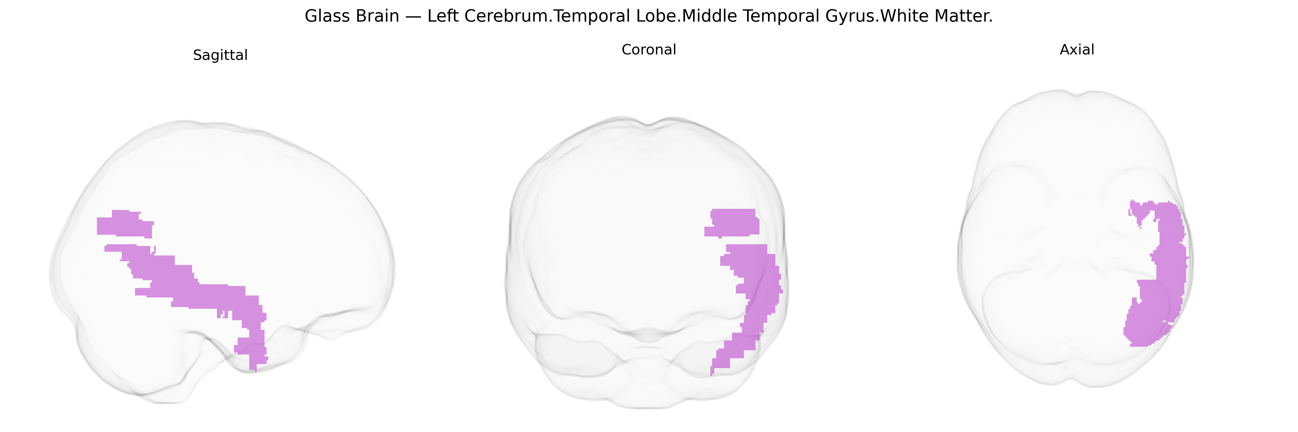 Triplanar Ghost Brain