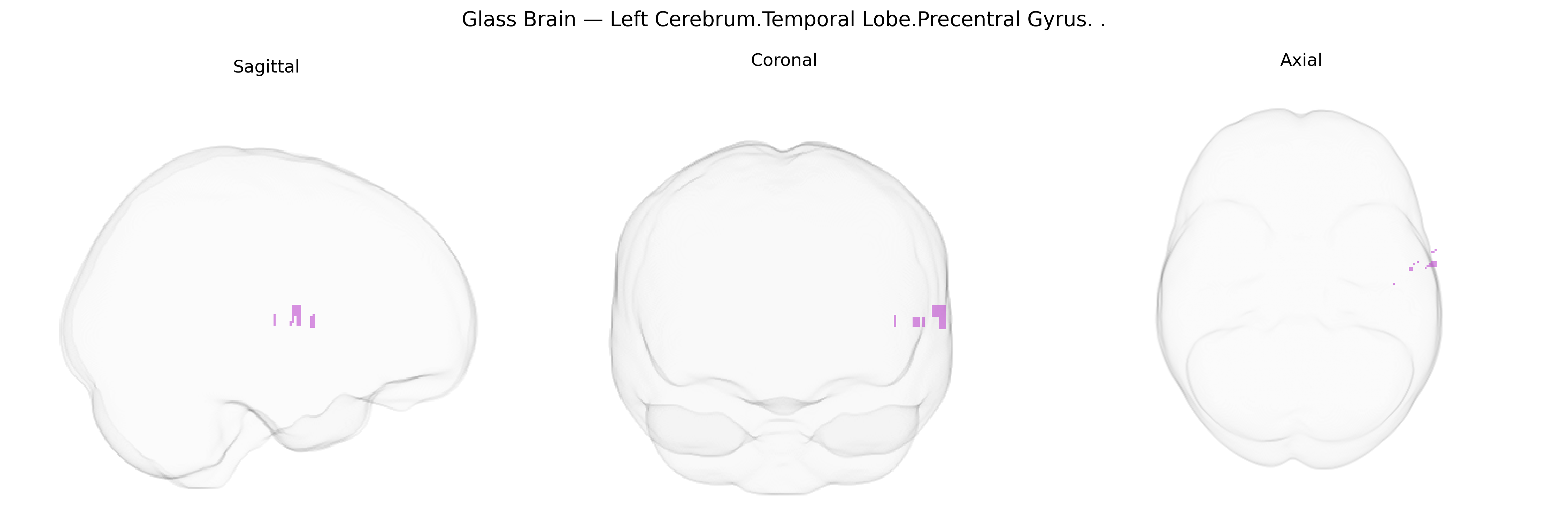 Triplanar Ghost Brain