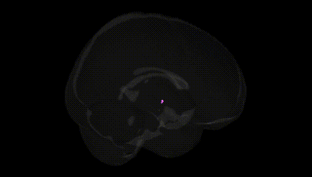 Full Brain Black