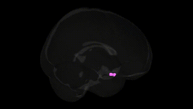 Full Brain Black