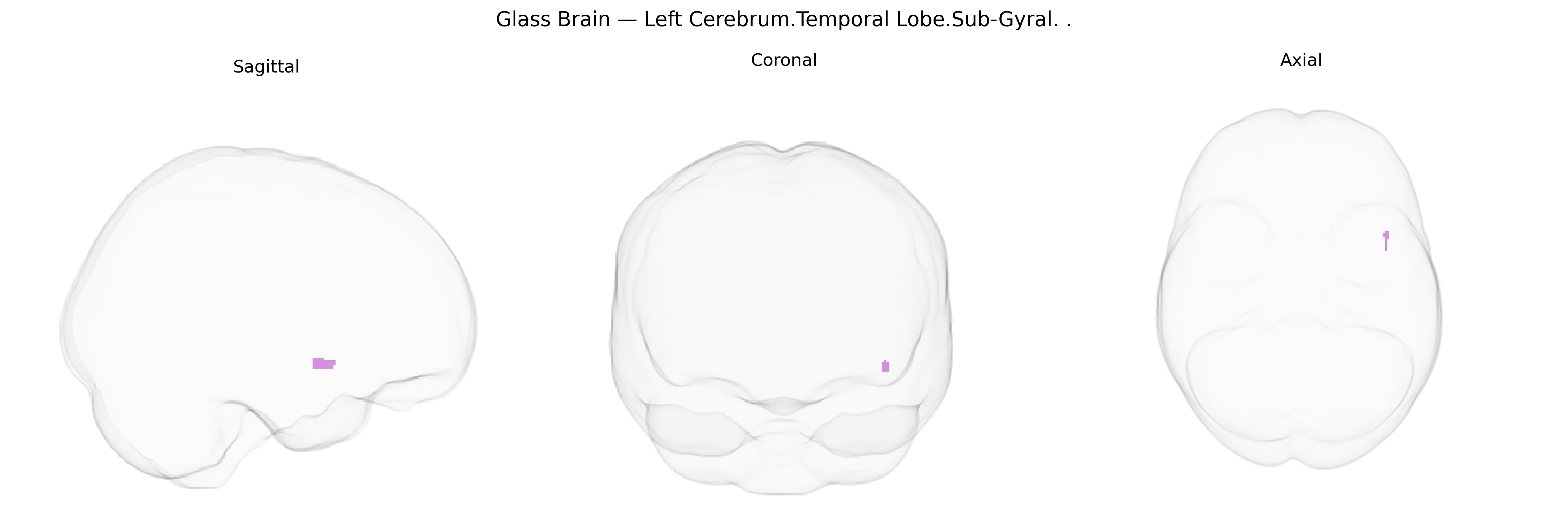 Triplanar Ghost Brain