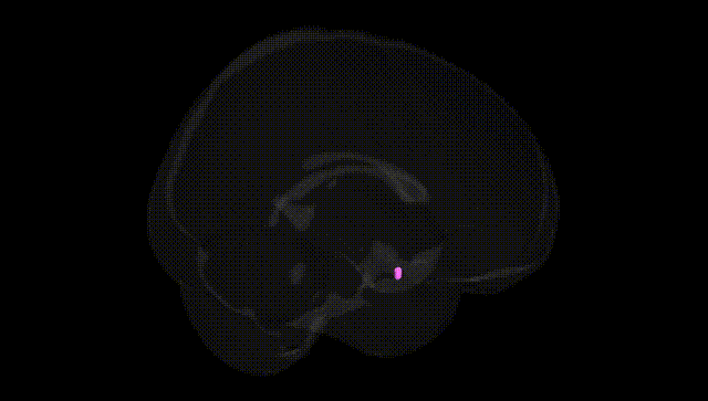 Full Brain Black