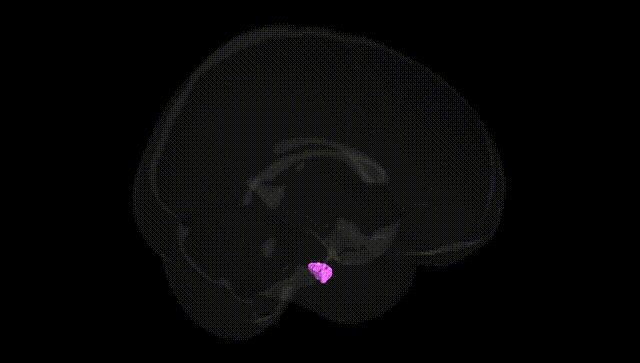 Full Brain Black