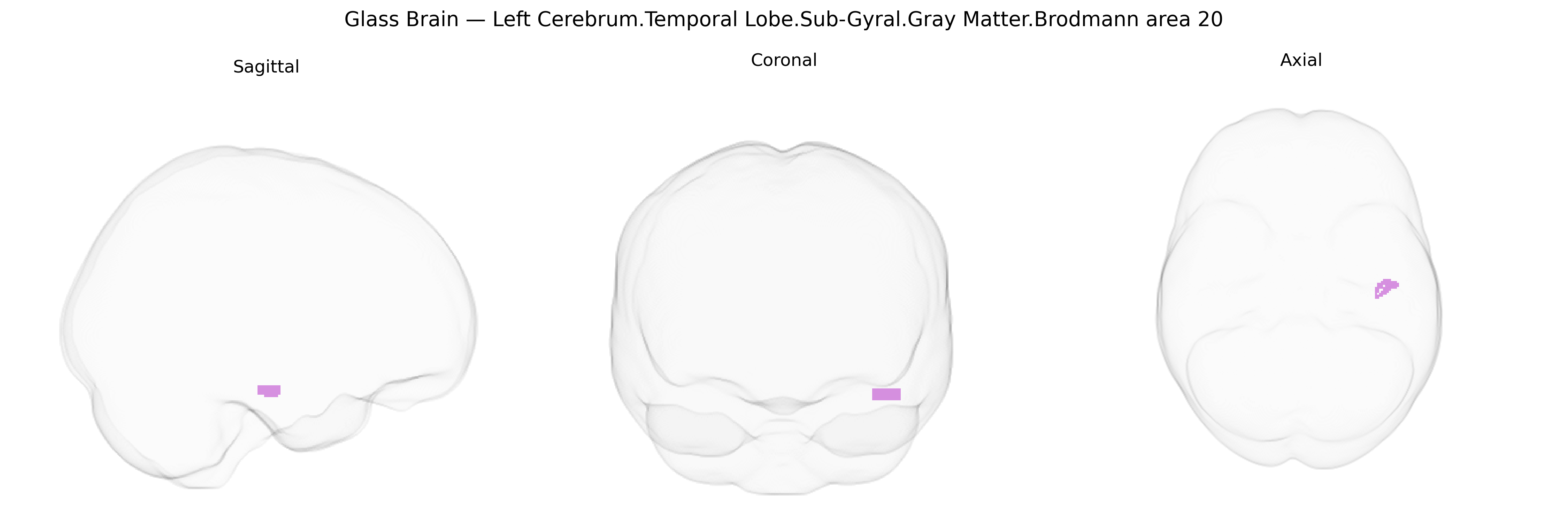 Triplanar Ghost Brain