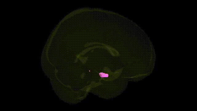 Full Brain Black