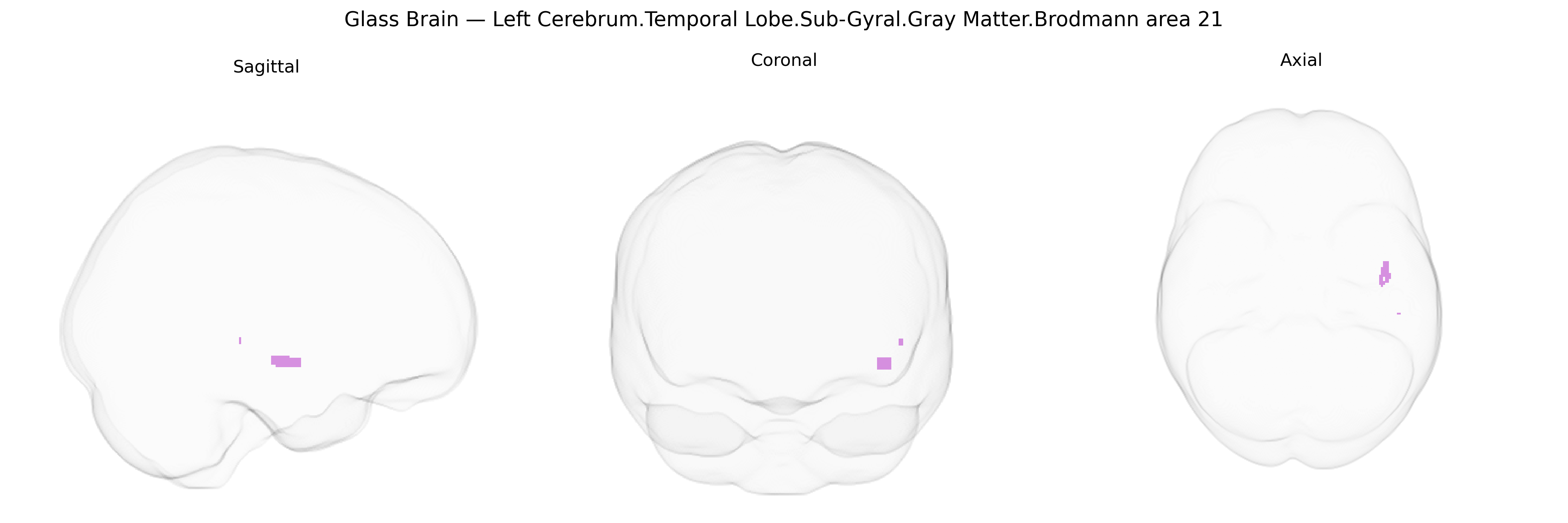 Triplanar Ghost Brain