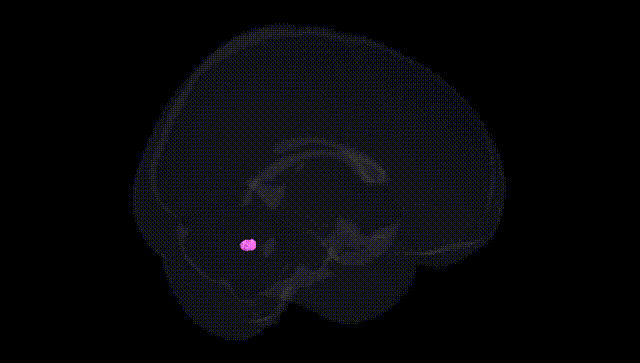 Full Brain Black