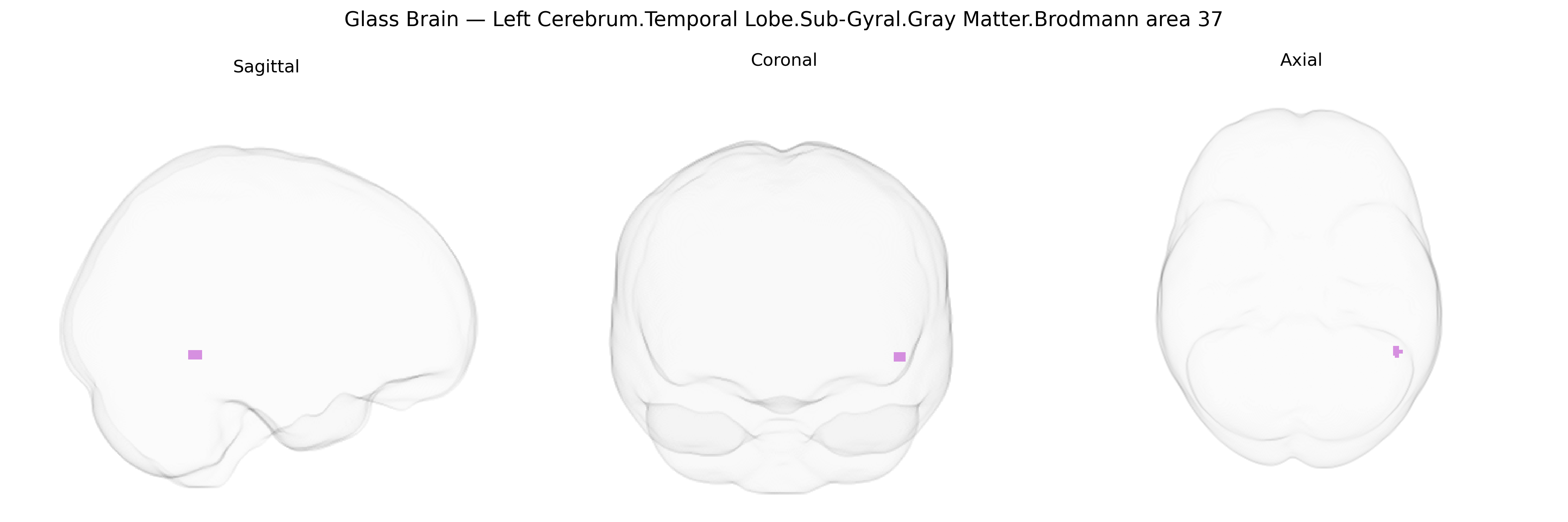 Triplanar Ghost Brain