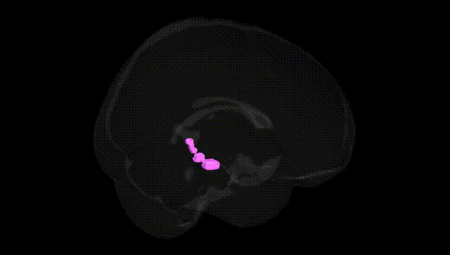 Full Brain Black