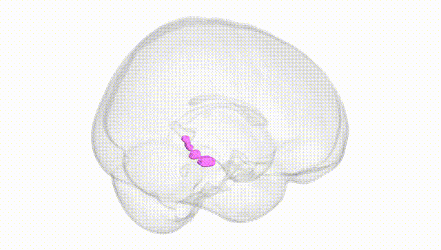 Full Brain White