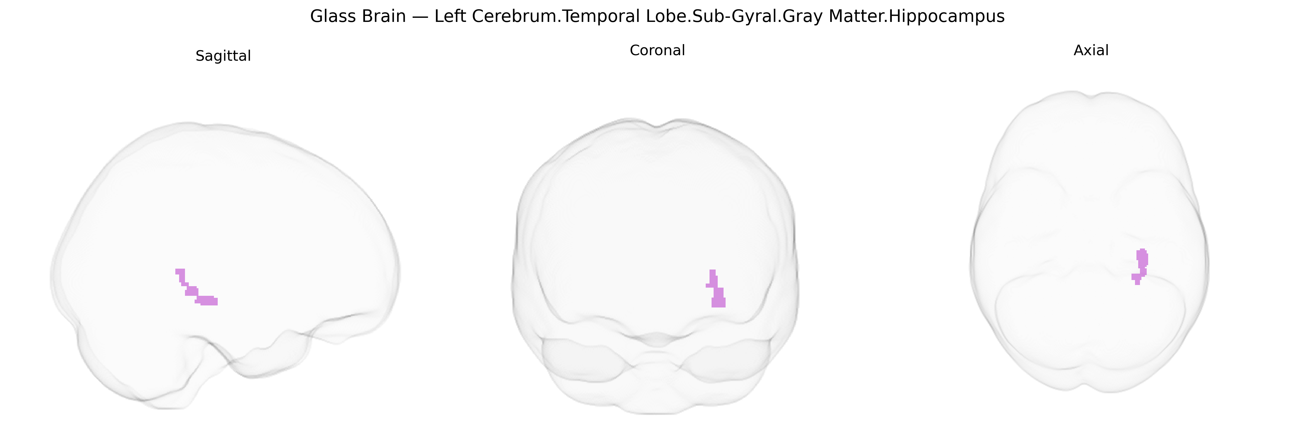 Triplanar Ghost Brain