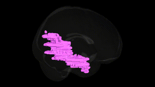 Full Brain Black