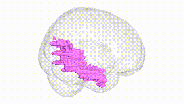 Full Brain White
