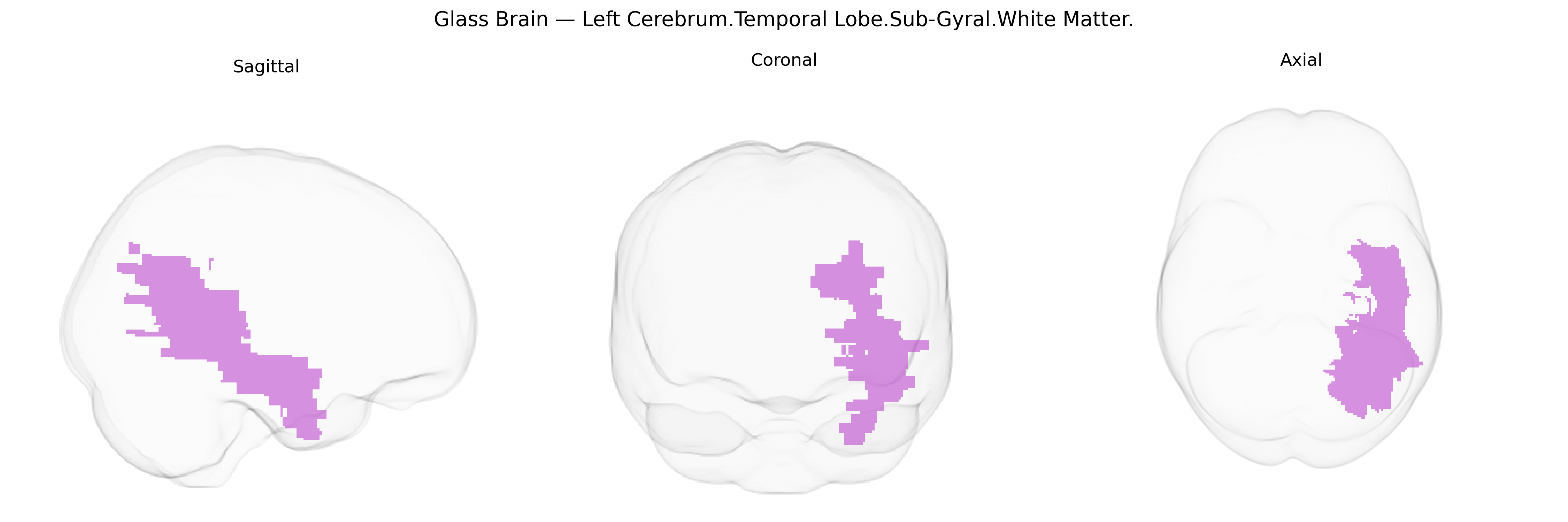 Triplanar Ghost Brain