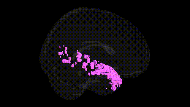 Full Brain Black