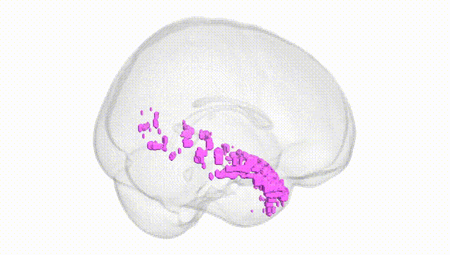 Full Brain White