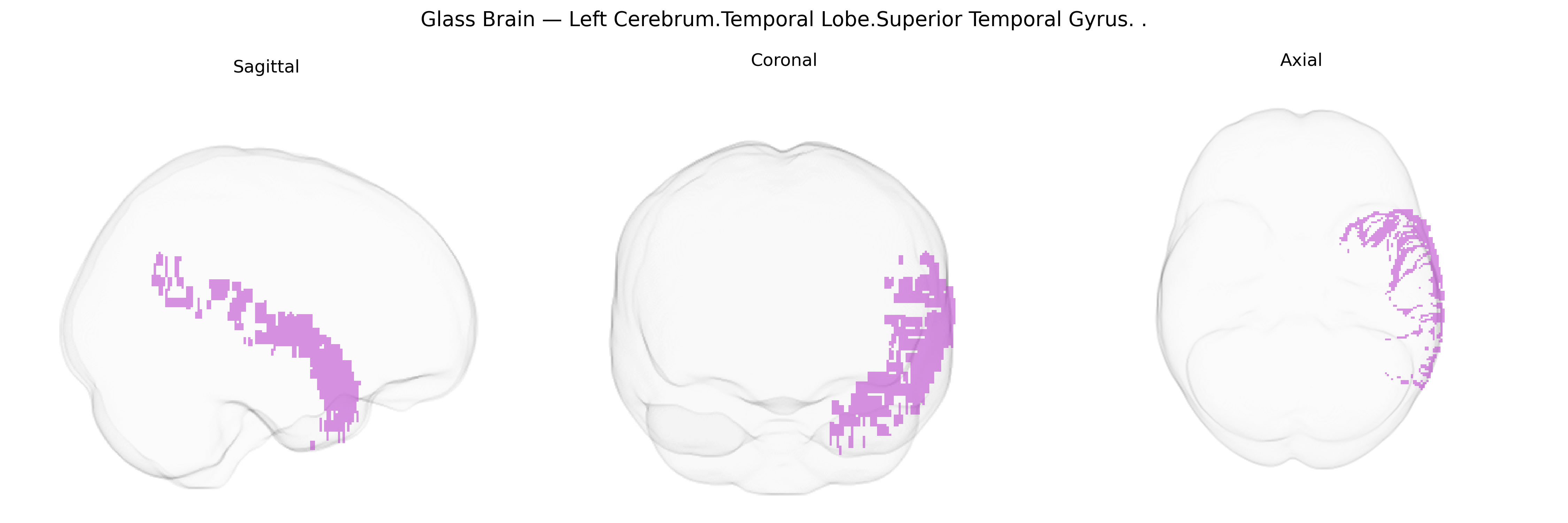 Triplanar Ghost Brain
