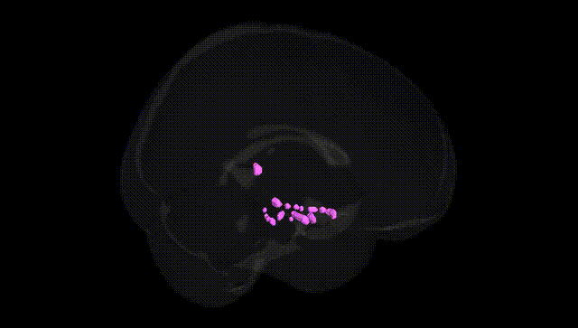 Full Brain Black