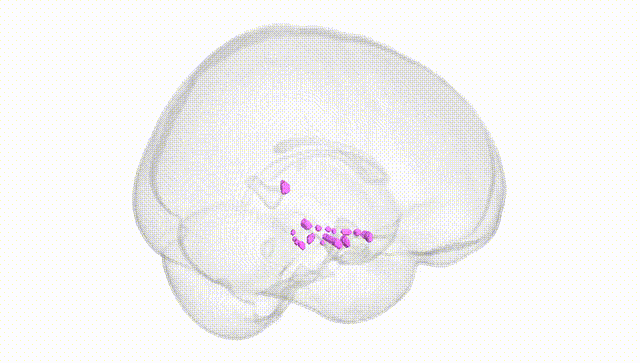 Full Brain White