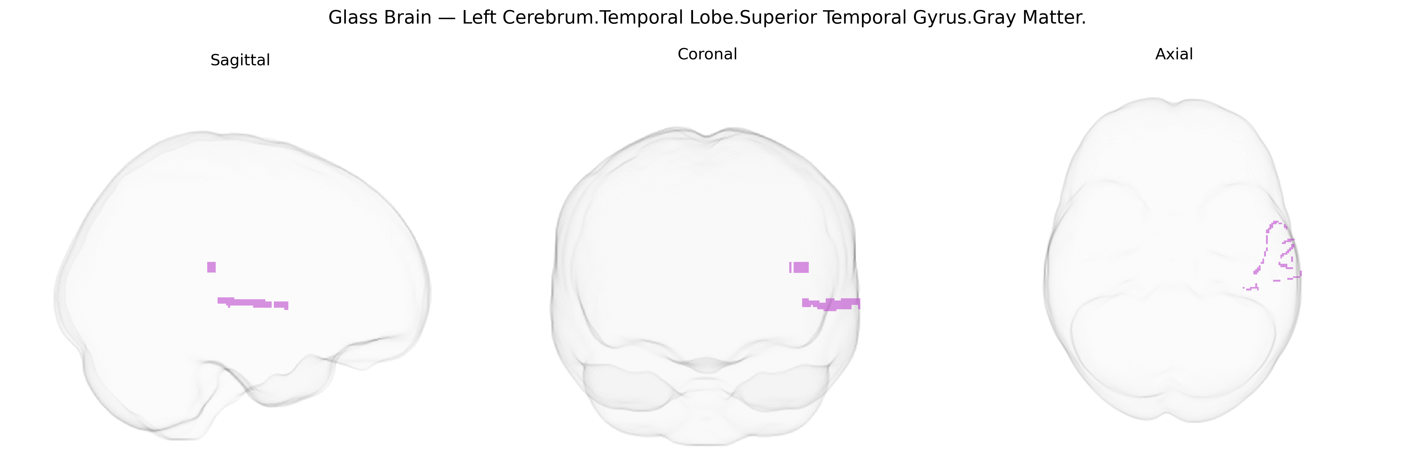Triplanar Ghost Brain