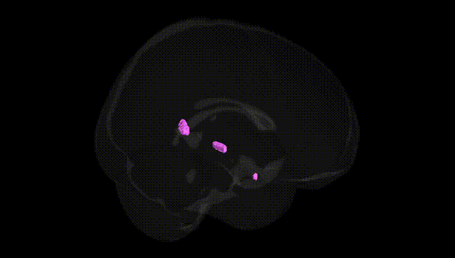Full Brain Black