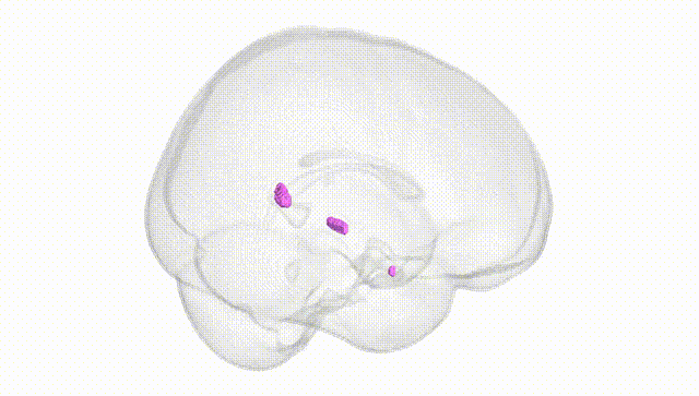 Full Brain White