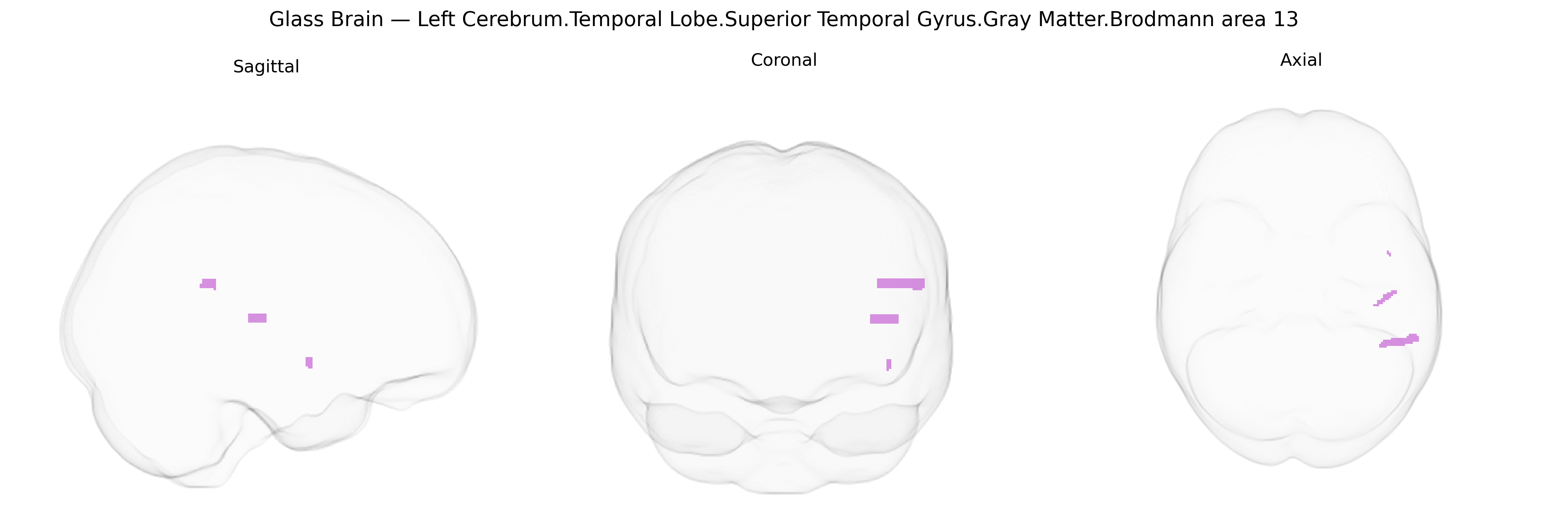 Triplanar Ghost Brain