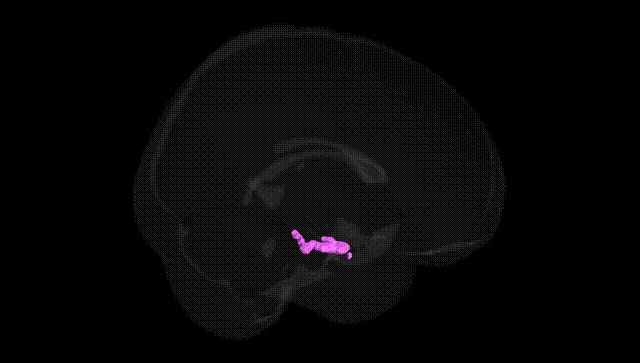 Full Brain Black