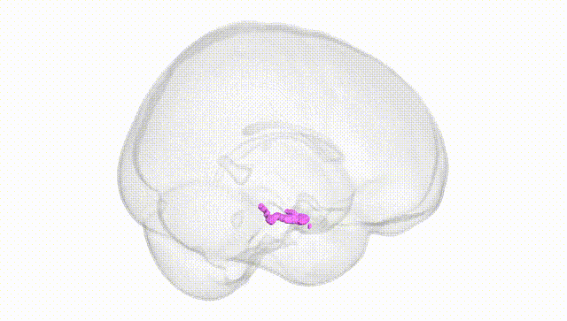 Full Brain White
