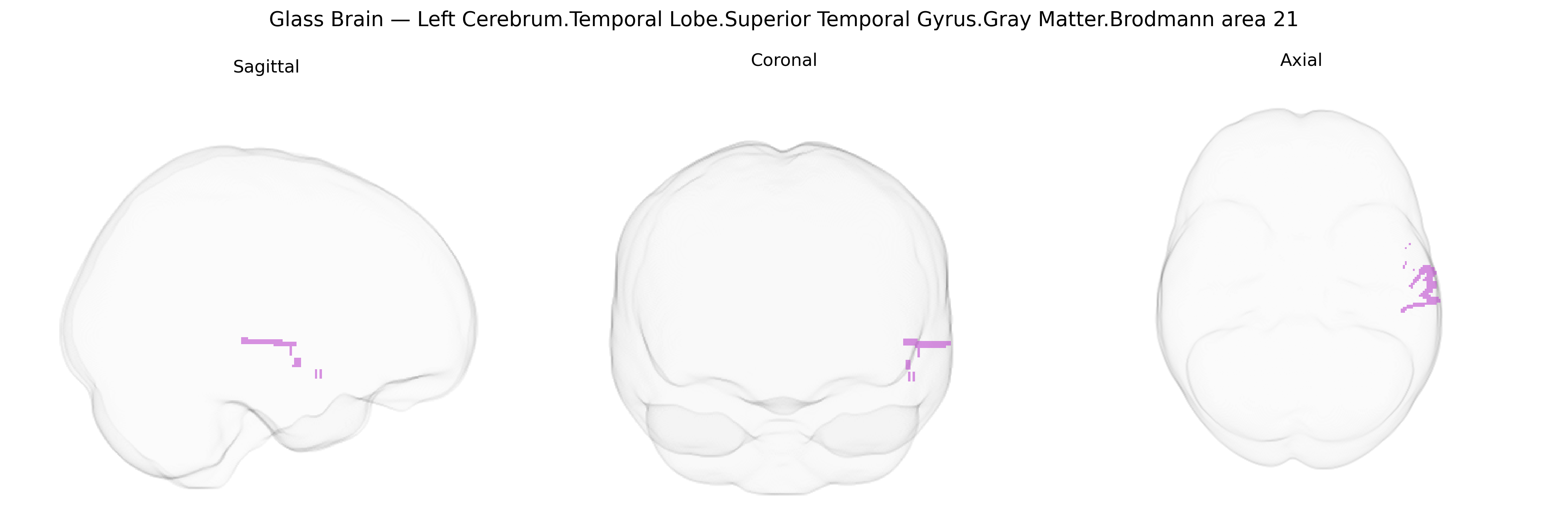 Triplanar Ghost Brain