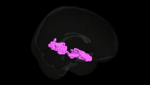Full Brain Black