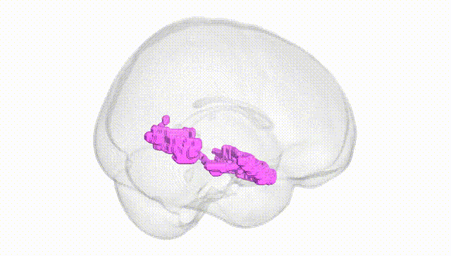 Full Brain White