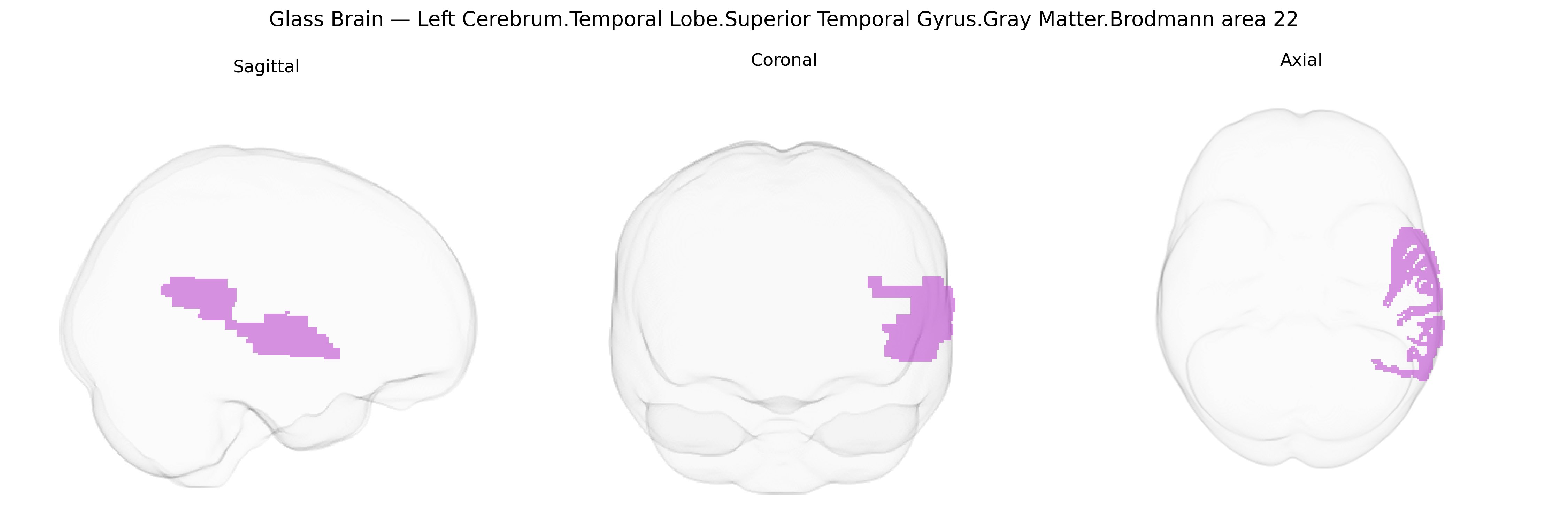 Triplanar Ghost Brain