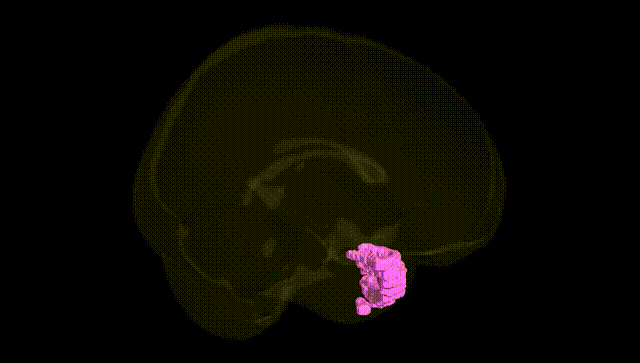Full Brain Black